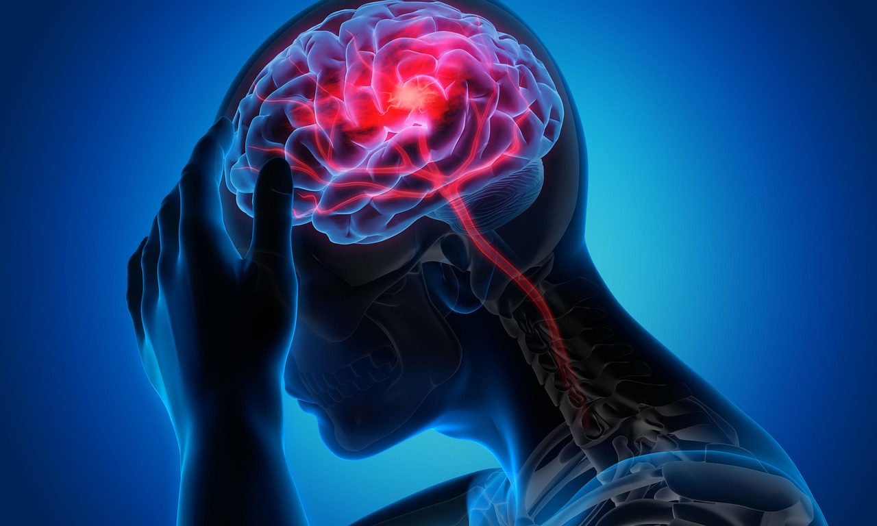 Headche / Migraine